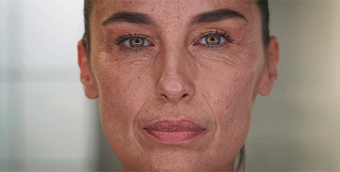 Hyperpigmentation solutions from md:ceuticals