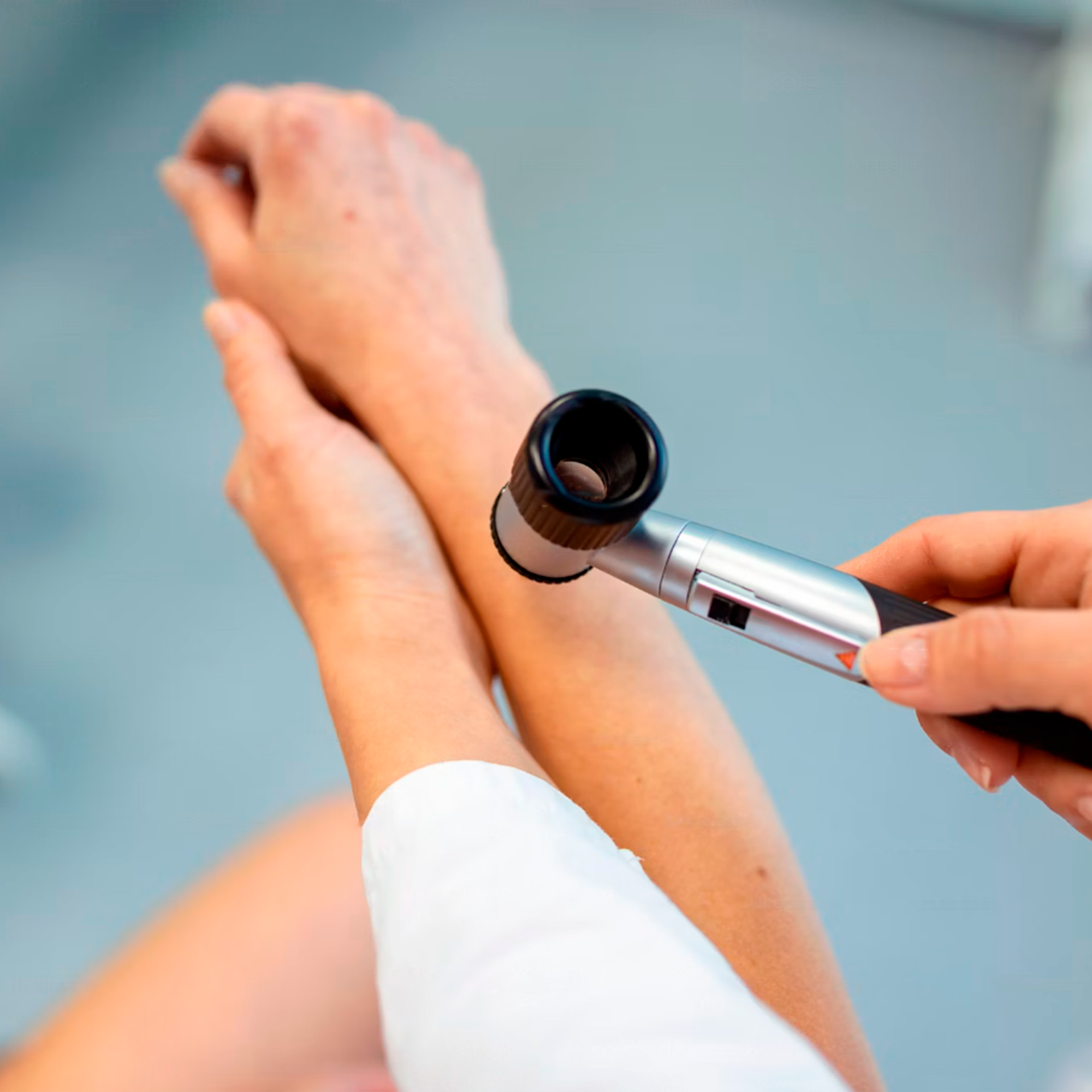 Learn how to detect melanoma by regularly checking your skin, recognising the ABCDEs of melanoma, and consulting a dermatologist for any concerns